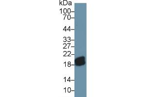 Detection of CPLX2 in Mouse Cerebrum lysate using Polyclonal Antibody to Complexin 2 (CPLX2) (CPLX2 antibody  (AA 2-134))