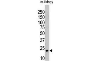 The ISG15 polyclonal antibody  is used in Western blot to detect ISG15 in mouse kidney tissue lysate.