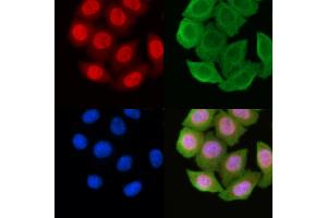 ABIN6256976 and ABIN6274481 staining Hela cells(45 min of heat-shock) by IF/ICC.