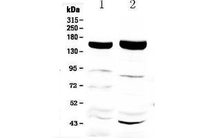 Western blot analysis of Xanthine Oxidase using anti-Xanthine Oxidase antibody .