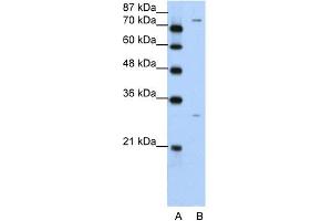 WB Suggested Anti-PTGS1 Antibody Titration:  5. (PTGS1 antibody  (N-Term))