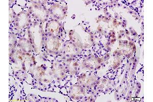 Formalin-fixed and paraffin embedded rat kidney tissue labeled with Anti-AGEs Polyclonal Antibody, Unconjugated (ABIN738516) at 1:200 followed by conjugation to the secondary antibody and DAB staining (AGE antibody)