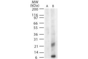 Image no. 2 for anti-West Nile Virus Matrix (WNV M) (AA 8-27) antibody (ABIN199989) (WNV M antibody  (AA 8-27))