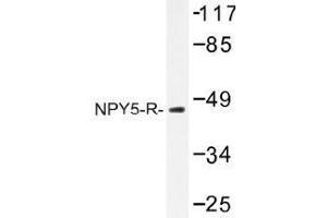 Image no. 1 for anti-Neuropeptide Y Receptor Y5 (NPY5R) antibody (ABIN317759) (NPY5R antibody)