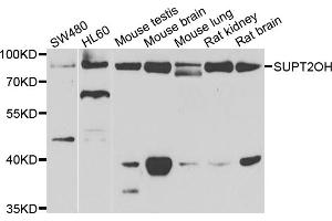 Western blot analysis of extracts of various cell lines, using SUPT20H antibody (ABIN5975125) at 1/1000 dilution.