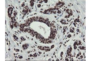 Immunohistochemical staining of paraffin-embedded Human breast tissue using anti-CHN1 mouse monoclonal antibody. (CHN1 antibody)