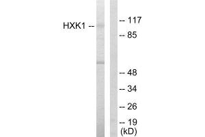 Western Blotting (WB) image for anti-Hexokinase 1 (HK1) (N-Term) antibody (ABIN1849225) (Hexokinase 1 antibody  (N-Term))