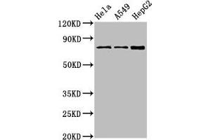 Western Blot Positive WB detected in: Hela whole cell lysate, A549 whole cell lysate, HepG2 whole cell lysate All lanes: TGM2 antibody at 4 μg/mL Secondary Goat polyclonal to rabbit IgG at 1/50000 dilution Predicted band size: 78, 62, 39 kDa Observed band size: 78 kDa (Transglutaminase 2 antibody  (AA 4-544))