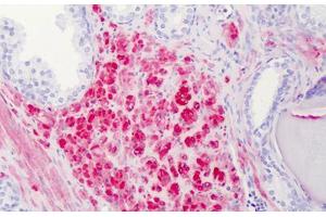 Human Prostate: Formalin-Fixed, Paraffin-Embedded (FFPE) (Calponin antibody  (AA 1-298))