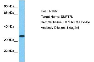 Host: Rabbit Target Name: SUPT7L Sample Type: HepG2 Whole Cell lysates Antibody Dilution: 1. (SUPT7L antibody  (C-Term))