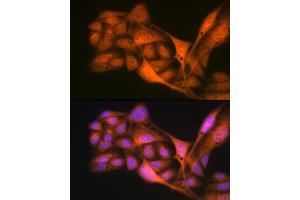 Immunofluorescence analysis of U-2 OS cells using Gli3 Rabbit mAb (ABIN7267385) at dilution of 1:100 (40x lens). (GLI3 antibody)