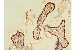 Immunohistochemistry of paraffin-embedded human placenta tissue using ABIN7146564 at dilution of 1:100 (Calreticulin antibody  (AA 18-415))