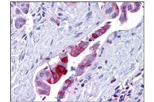 Human Pancreas, Duct: Formalin-Fixed, Paraffin-Embedded (FFPE) (Retinoblastoma Binding Protein 8 antibody)
