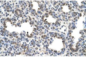 Human Lung (Butyrylcholinesterase antibody  (N-Term))