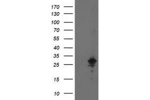 HEK293T cells were transfected with the pCMV6-ENTRY control (Left lane) or pCMV6-ENTRY AK4 (Right lane) cDNA for 48 hrs and lysed. (AK4 antibody)