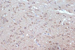 Immunohistochemistry of paraffin-embedded rat brain using B Rabbit mAb (ABIN7265849) at dilution of 1:100 (40x lens). (BAG2 antibody)