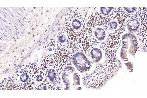 Detection of IL6 in Rabbit Colon Tissue using Monoclonal Antibody to Interleukin 6 (IL6) (IL-6 antibody  (AA 27-241))