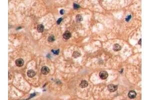 Detection of VEGF165 in Human Liver Tissue using Monoclonal Antibody to Vascular Endothelial Growth Factor 165 (VEGF165) (VEGF 165 (AA 28-191) antibody)