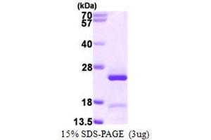 SDS-PAGE (SDS) image for Growth Arrest and DNA-Damage-Inducible, gamma Interacting Protein 1 (GADD45GIP1) (AA 48-222) protein (His tag) (ABIN667977) (GADD45GIP1 Protein (AA 48-222) (His tag))