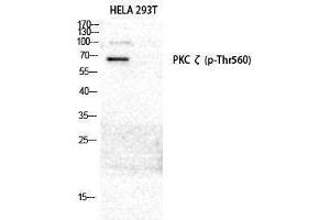 Western Blotting (WB) image for anti-Protein Kinase C, zeta (PRKCZ) (pThr560) antibody (ABIN3172963) (PKC zeta antibody  (pThr560))