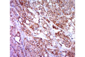 Paraformaldehyde-fixed, paraffin embedded human liver carcinoma; Antigen retrieval by boiling in sodium citrate buffer (pH6. (HRH4 antibody  (AA 285-390))