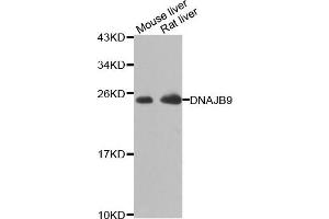 Western blot analysis of extracts of various cell lines, using DNAJB9 antibody. (DNAJB9 antibody)