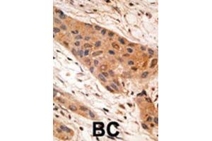Immunohistochemistry (IHC) image for anti-BCL2/adenovirus E1B 19kDa Interacting Protein 1 (BNIP1) (BH3 Domain) antibody (ABIN2997180) (BNIP1 antibody  (BH3 Domain))