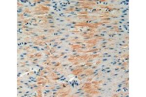 Used in DAB staining on fromalin fixed paraffin- embedded stomach tissue (IGFBP6 antibody  (AA 46-238))