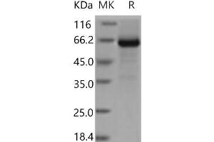 Western Blotting (WB) image for Glycoprotein Ib (Platelet), beta Polypeptide (GP1BB) protein (Fc Tag) (ABIN7321086) (GP1BB Protein (Fc Tag))