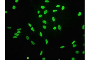 Immunofluorescence staining of Hela cells(treated by 15 mM sodium butyrate for 30 min) with ABIN7127269 at 1:68,counter-stained with DAPI. (Recombinant HIST1H3A antibody  (H3K4ac))