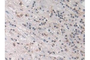Detection of LCP1 in Human Appendix Tissue using Polyclonal Antibody to L-Plastin (LCP1) (LCP1 antibody  (AA 5-233))