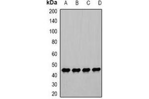 Western blot analysis of PGK1 expression in Hela (A), PC3 (B), ES2 (C), mouse stomach (D) whole cell lysates. (PGK1 antibody)