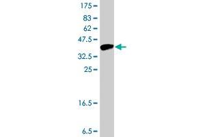 Western Blot detection against Immunogen (37 KDa) . (PRSS8 antibody  (AA 33-131))