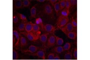 Immunofluorescence staining of methanol-fixed MCF7 cells using KDR (phospho Y1175) polyclonal antibody . (VEGFR2/CD309 antibody  (pTyr1175))