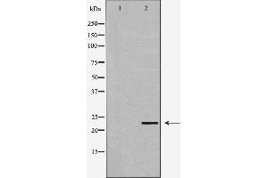 Western blot analysis of Hela whole cell lysates, using GSTP1 Antibody. (GSTP1 antibody  (N-Term))