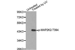 Western blot analysis of extracts from HepG2 cells using Phospho-MAP2K2-T394 antibody (ABIN2987359). (MEK2 antibody  (pThr394))