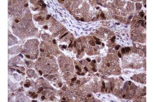Image no. 2 for anti-Antigen Identified By Monoclonal Antibody Ki-67 (MKI67) (AA 2924-3256) antibody (ABIN1491345) (Ki-67 antibody  (AA 2924-3256))