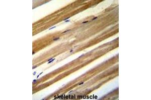 CU070 antibody (C-term) immunohistochemistry analysis in formalin fixed and paraffin embedded human skeletal muscle followed by peroxidase conjugation of the secondary antibody and DAB staining. (CU070 Protein antibody  (C-Term))