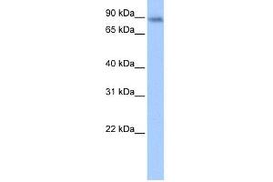 WB Suggested Anti-JAKMIP1 Antibody Titration:  0.