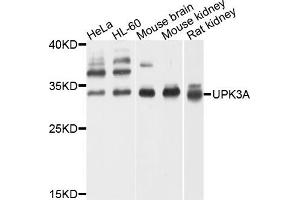 Western blot analysis of extracts of various cells, using UPK3A antibody. (Uroplakin 3A antibody)