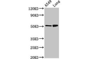 Western Blot Positive WB detected in: A549 whole cell lysate, Rat lung tissue All lanes: IRX3 antibody at 5 μg/mL Secondary Goat polyclonal to rabbit IgG at 1/50000 dilution Predicted band size: 53 kDa Observed band size: 53 kDa (IRX3 antibody  (AA 285-378))