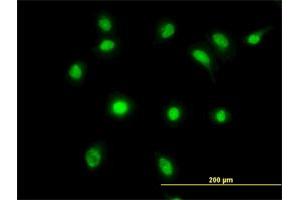 Immunofluorescence of monoclonal antibody to LDB2 on HeLa cell. (LIM Domain Binding 2 Protein antibody  (AA 1-373))