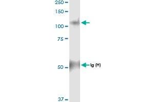 Immunoprecipitation of PYGL transfected lysate using anti-PYGL MaxPab rabbit polyclonal antibody and Protein A Magnetic Bead , and immunoblotted with PYGL MaxPab rabbit polyclonal antibody (D01) . (PYGL antibody  (AA 1-847))