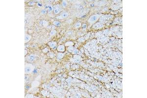 Immunohistochemistry of paraffin-embedded mouse spinal cord using E/SLC1 Rabbit mAb (ABIN7270394) at dilution of 1:100 (40x lens). (SLC1A3 antibody)