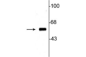 Western blot of 10ug of rat striatal lysate showing specific immunolabeling of the ~60 kDa tyrosine hydroxylase protein. (Tyrosine Hydroxylase antibody)