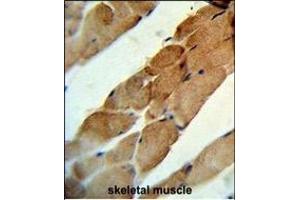 Formalin-fixed and paraffin-embedded human skeletal muscle reacted with TNFSF11 Antibody (N-term), which was peroxidase-conjugated to the secondary antibody, followed by DAB staining. (RANKL antibody  (N-Term))