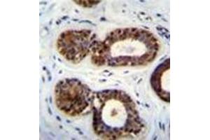 Immunohistochemistry (Paraffin-embedded Sections) (IHC (p)) image for anti-Queuine tRNA-Ribosyltransferase Domain Containing 1 (QTRTD1) (AA 328-359), (C-Term) antibody (ABIN954399)