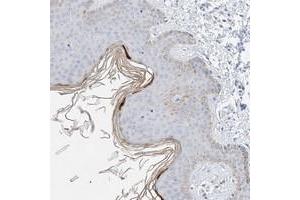 Immunohistochemical staining of human skin with KPRP polyclonal antibody  shows positivity in upper layer of epidermis at 1:200-1:500 dilution. (KPRP antibody)