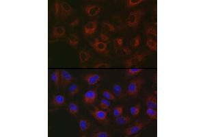 Immunofluorescence (IF) image for anti-Glycosylphosphatidylinositol Specific phospholipase D1 (GPLD1) (AA 24-160) antibody (ABIN6141335)