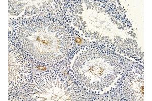 ABIN6264694 and ABIN6278626 at 1/100 staining rat testis tissue by IHC-P.